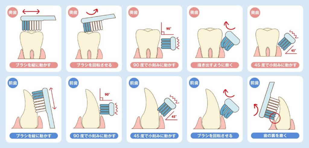 自分でできる歯周病予防・ケア方法